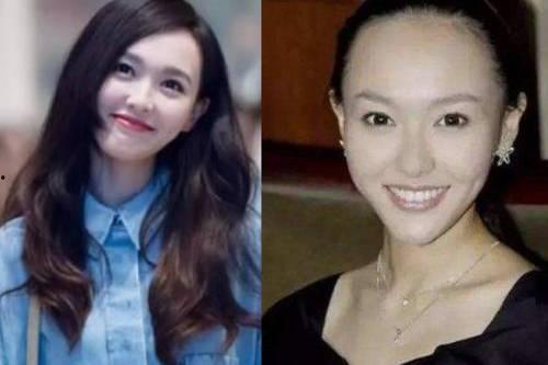 明星刘海发际线视频,时尚潮流还是健康警示？