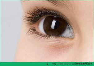 有飞蚊症的明星,揭秘有飞蚊症的明星们